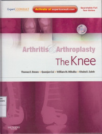 Arthritis and Arthroplasty: The Knee