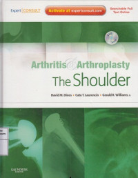 Arthritis and Arthroplasty: The Shoulder